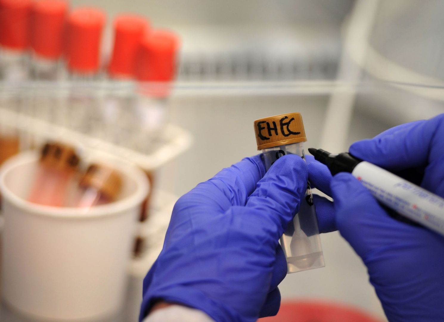 Ehec-Bakterien