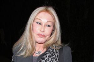 Jocelyn Wildenstein