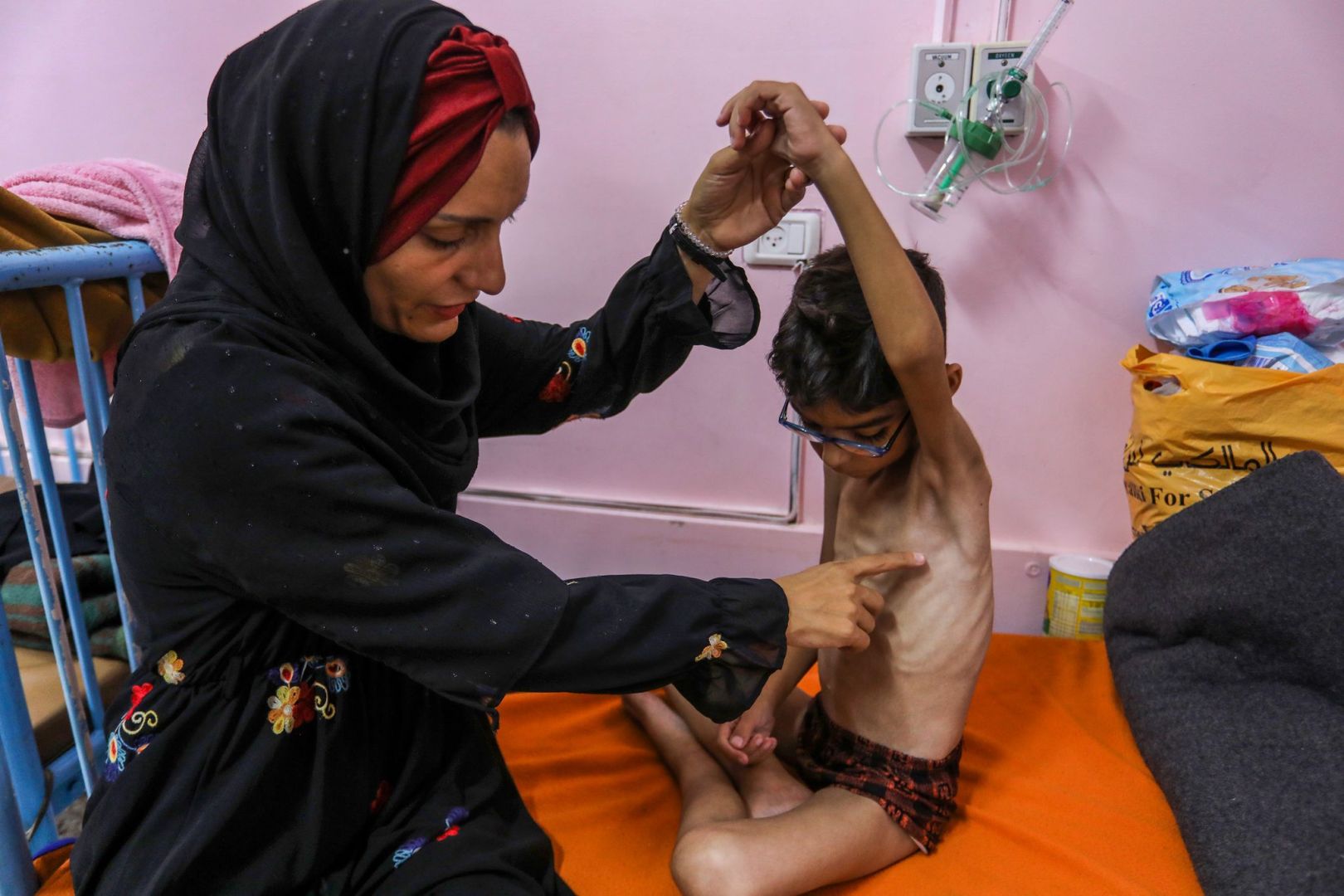 Nahost-Konflikt - Unterernährte palästinensische Kinder