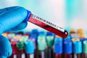 Statt Blutspenden: Kommt »menschliches« Blut schon bald aus dem Labor?