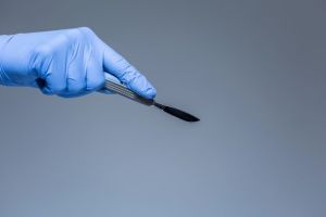 Videobrille im OP: In Sinsheim schauen Patienten unter lokaler Betäubung Filme