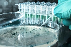 Abivax vor dem entscheidenden Jahr – Zulassungsantrag für Obefazimod rückt näher