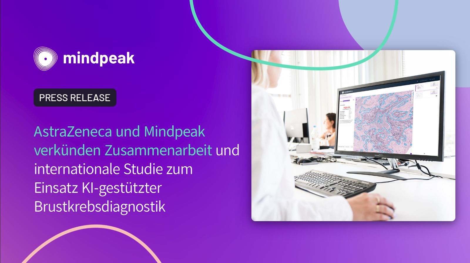AstraZeneca und Mindpeak verkünden Zusammenarbeit und internationale Studie zum Einsatz KI-gestützter Brustkrebsdiagnostik