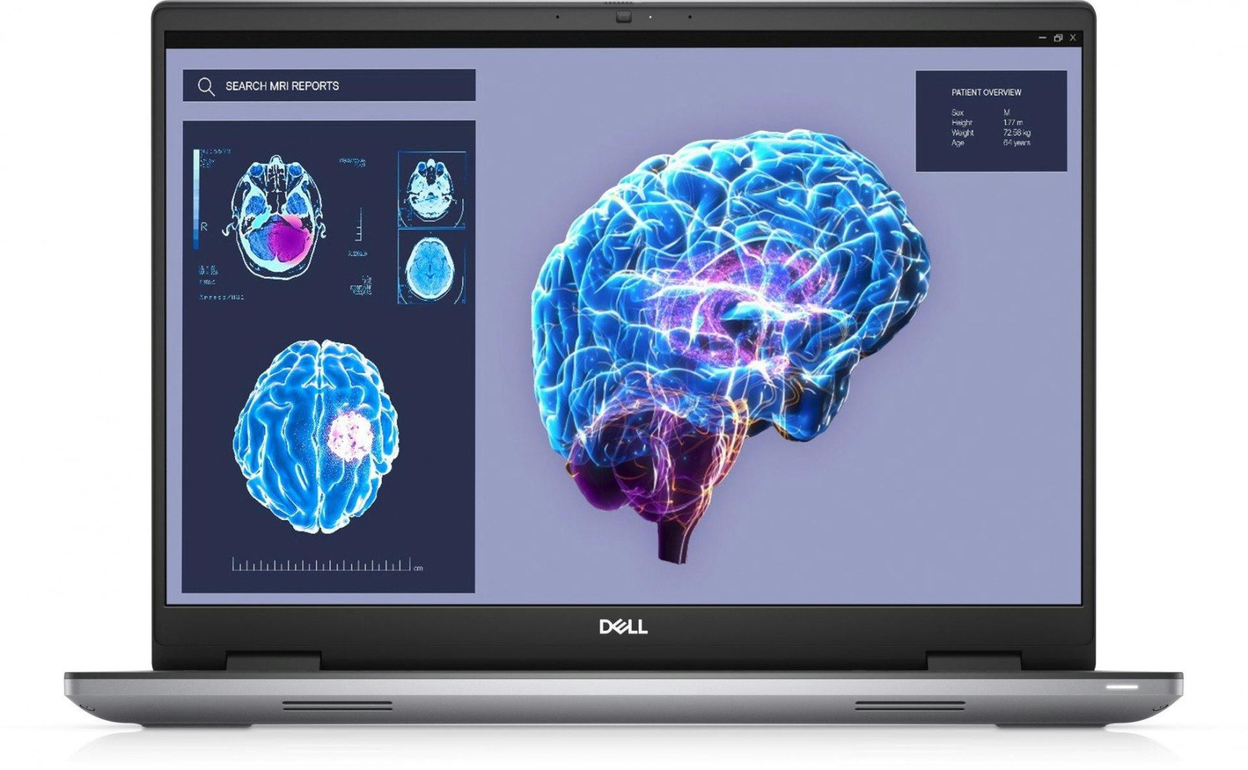 Dell knackt Rekorde: KI-Server treiben Umsatz in die Höhe – Jahresziele zum zweiten Mal angehoben