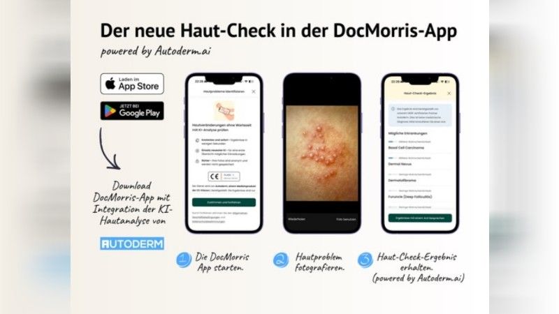 DocMorris AUTODERM – Kostenfreie digitale Ersteinschätzung bei Hautproblemen mit KI-App