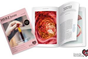 Gefäßkiller LDL-Cholesterin: Sind Butter, Eier, Käse Übeltäter?