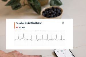 Gesundheitsdaten erfassen: Herzrhythmus eigenständig beobachten mit AliveCor
