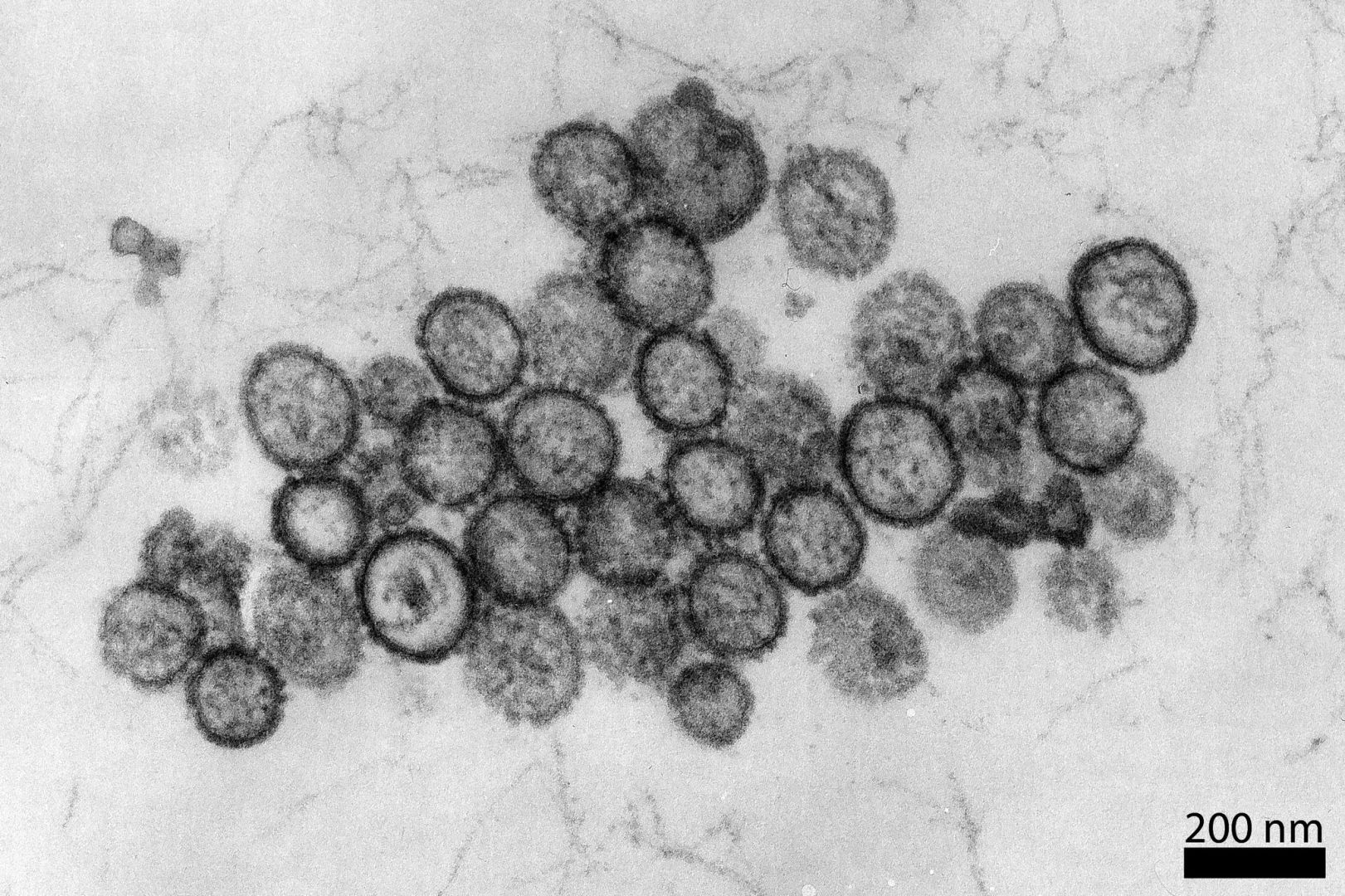 Hantavirus