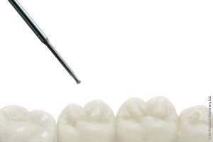 Harte Diamantschichten von CemeCon schlagen die Brücke in den wachsenden Dentalmarkt