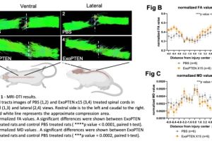 NurExone Biologic kündigt präklinische Evidenz für strukturelle Reparatur von geschädigtem Rückenmarksgewebe nach ExoPTEN-Behandlung an