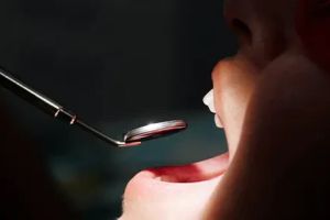 Parodontitis erkennen und vorbeugen: So schützen Sie Ihr Zahnfleisch und Ihren Kieferknochen