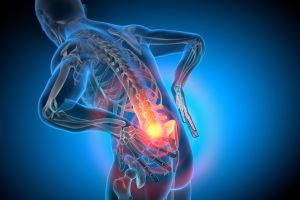 Postdiskektomie-Syndrom – wenn der Rücken nach der OP weiter Schmerzen versursacht