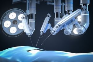 Roboter entfernt per Sprachbefehl Organe mit 100-prozentigem Erfolg